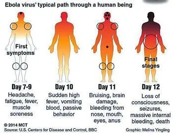 8 Fakta yang Perlu Kamu Tahu Agar Tidak Panik Menghadapi Virus Ebola 12