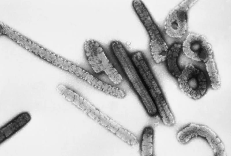 Bukan HIV Atau Ebola: Berikut Daftar Virus Paling Berbahaya Yang Mengancam Manusia 10