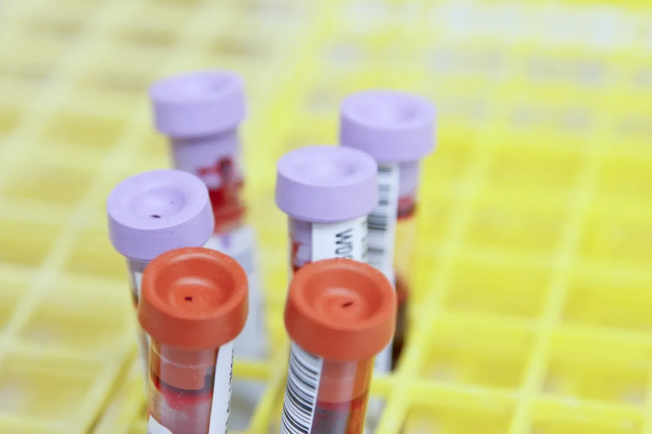 9 Hal yang Perlu Diingat Sebelum Bilang Kamu Takut Donor Darah 19