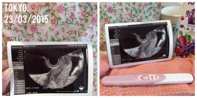 Halo, Calon Ibu Muda! 7 Hal Ini yang Akan Membantumu Selama Trimester Pertama 10