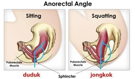 Kloset Jongkok Itu Bukannya