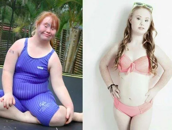 Lupakan Tubuh Molek Ala Barbie, Cewek Down Syndrome Ini Akan Ubah Persepsimu Soal Kecantikan 6
