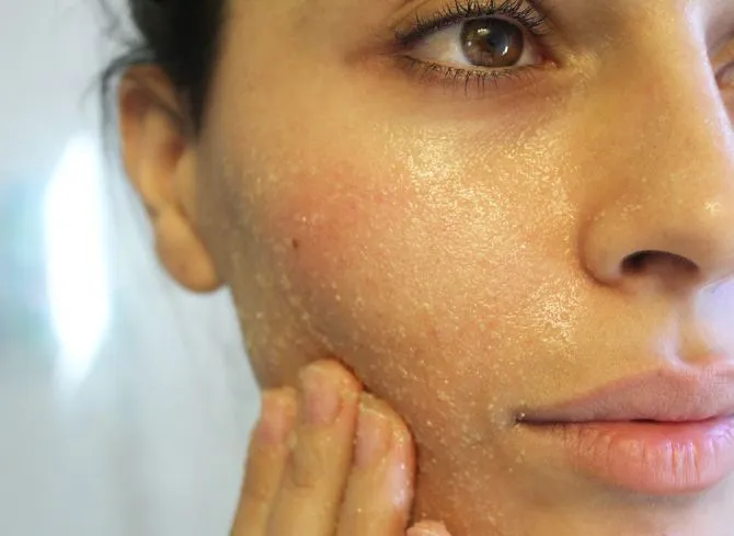 8 Tahapan Facial A La Rumahan yang Bikin Kulitmu Sehalus Hasil Perawatan di Klinik Kecantikan 11