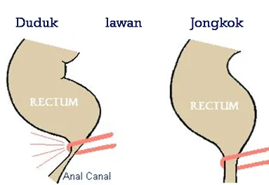 Kloset Jongkok Itu Bukannya
