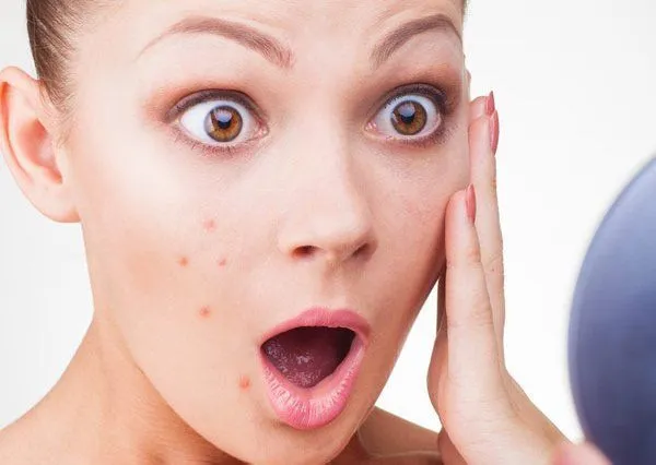 Cantik Harusnya Bikin Nyaman, Bukan Kesakitan. 8 Tips Cantik Anti Sakit Ini Layak Kamu Terapkan! 11