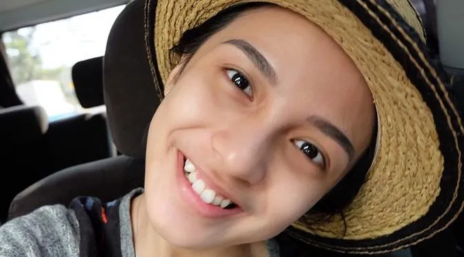 Cewek Bergigi Gingsul Emang Layak Disayang! 6 Hal Ini Jadi Alasan yang Menjelaskan 9