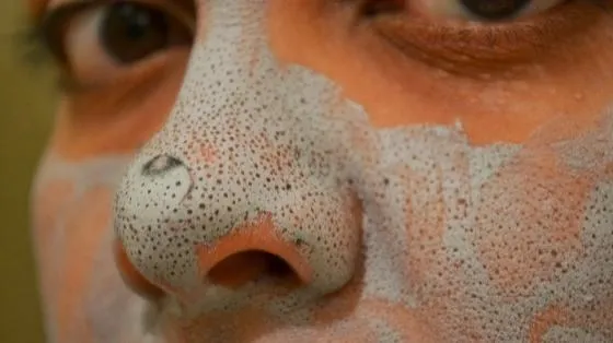 Komedo di Muka Emang Ngeselin. 7 Masker Sederhana Ini Bikin Komedo Menyingkir 12