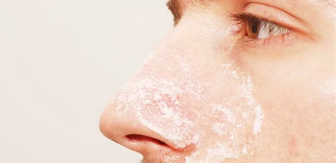 Komedo di Muka Emang Ngeselin. 7 Masker Sederhana Ini Bikin Komedo Menyingkir 9