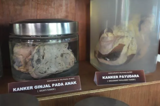 10 Museum Paling Unik Di Indonesia yang Nggak Akan Bikin Kamu Kecewa! Kapan Maen Ke Sana? 13