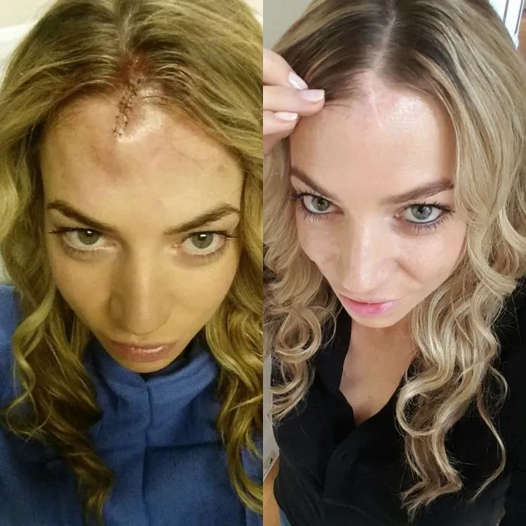 Inspirasi Megan Sullivan, Pengidap Kanker Kulit yang Sembuh Setelah Traveling ke 7 Keajaiban Dunia dalam 13 Hari! 12