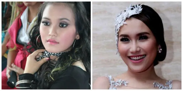 7 Artis Ini Bertransformasi dari Dulunya Biasa Menjadi Luar Biasa. Kamu Menyadari Perubahan Mereka Nggak? 13