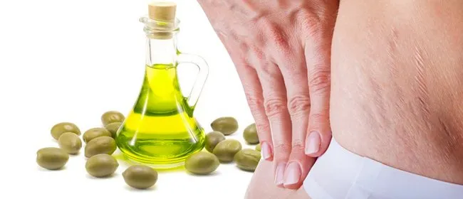 Agar Stretch Mark Hilang Perlahan, Jangan Lupa 8 Cara Ini Diterapkan! 12