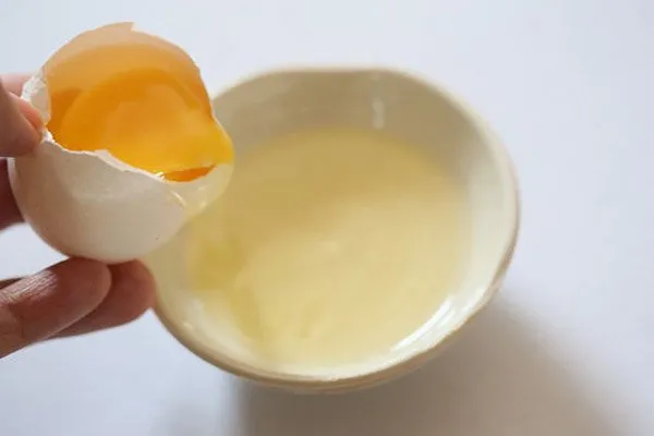Agar Stretch Mark Hilang Perlahan, Jangan Lupa 8 Cara Ini Diterapkan! 15
