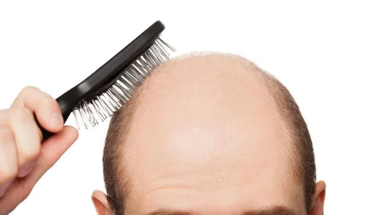 Pernah Salah Potong Rambut Atau Bad Hair Day? Ini 6 Cara yang Bisa Menyelamatkan Penampilanmu 9