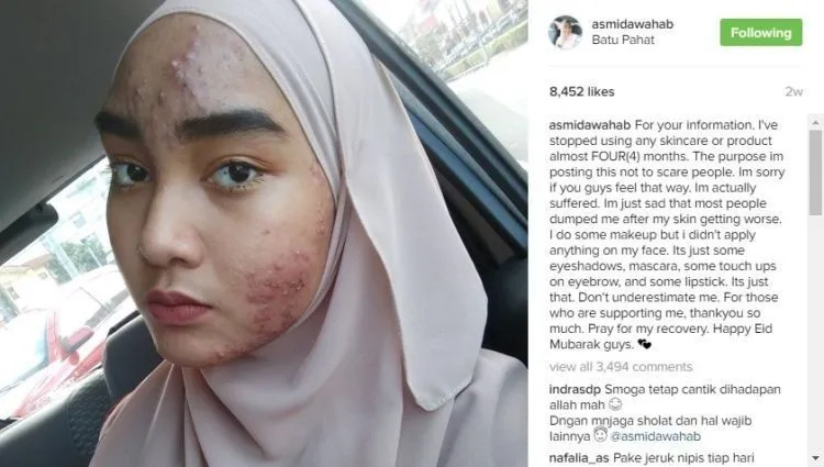Stop Merawat Wajah dengan Produk Berbahan Kimia, Kalau Ogah Wajahmu Rusak Seperti Asmida! 10