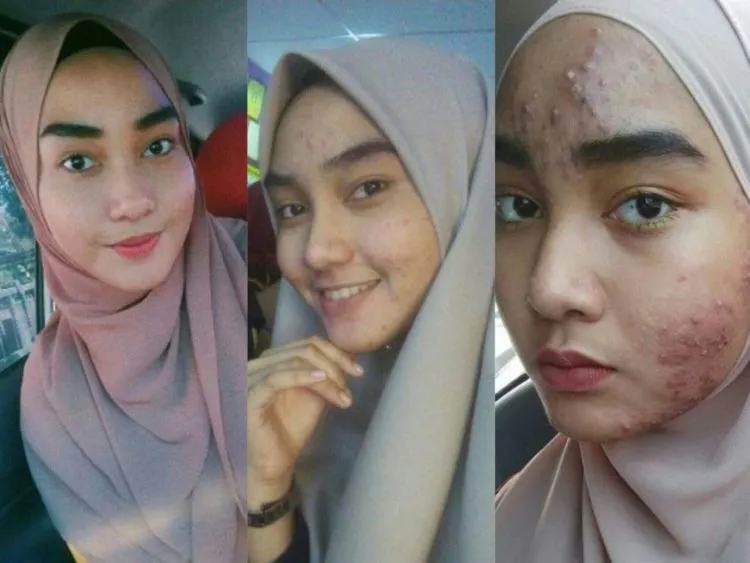 Stop Merawat Wajah dengan Produk Berbahan Kimia, Kalau Ogah Wajahmu Rusak Seperti Asmida! 9