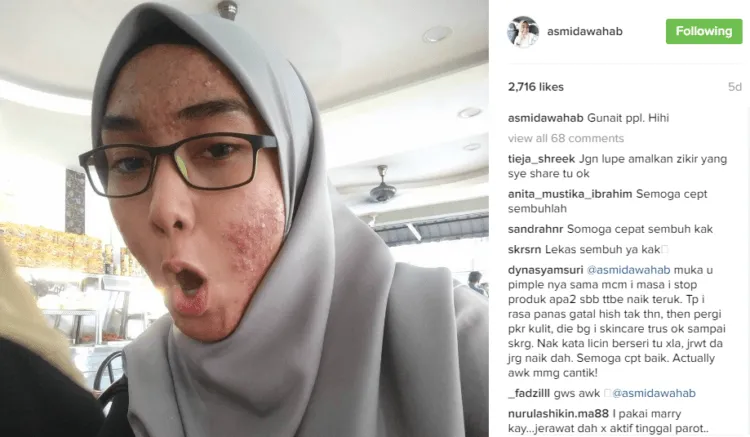 Stop Merawat Wajah dengan Produk Berbahan Kimia, Kalau Ogah Wajahmu Rusak Seperti Asmida! 14