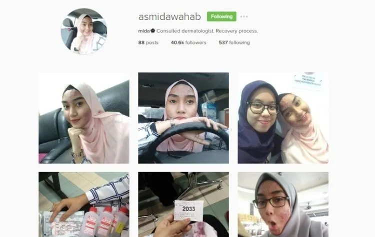 Stop Merawat Wajah dengan Produk Berbahan Kimia, Kalau Ogah Wajahmu Rusak Seperti Asmida! 8
