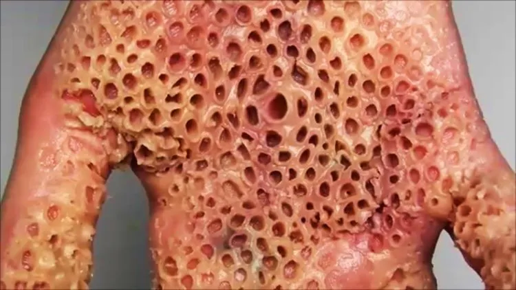 13 Jenis Phobia Ini Perlu Kamu Tahu. Jangan-jangan, Kamu Salah Satu Pengidapnya 22
