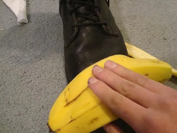 Bisa Bikin Awet Muda Sampai Memutihkan Gigi, Inilah 8 Khasiat Lain dari Kulit Pisang 16
