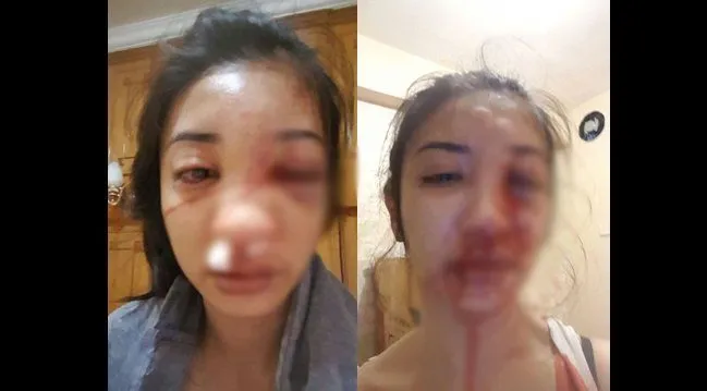 Kekerasan Dalam Hubungan yang Harus Segera Kamu Pahami, Jangan Sampai Seperti Kisah Saori Ishii 10