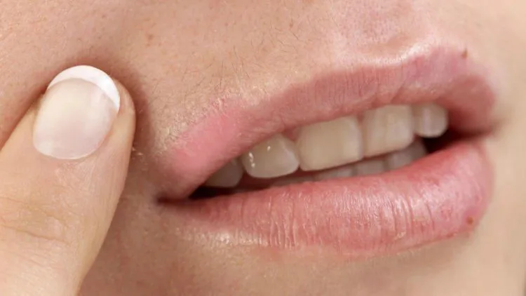 Menyatakan Rasa Sayang, Cium Kening Aja Cukup, 'Kan? Ini Bahaya Kalau Kamu Sering Ciuman Bibir dengan Pasanganmu! 8