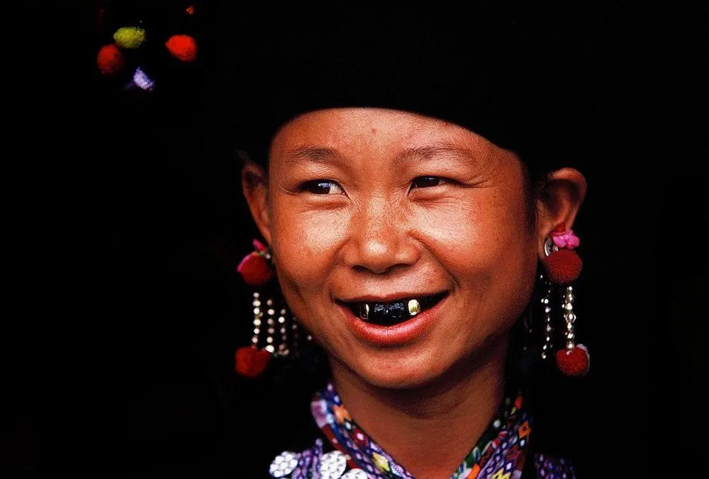 Wanita-Wanita Vietnam Ini Percaya Gigi Hitam Menambah Kecantikan Mereka. Unik Banget ya?