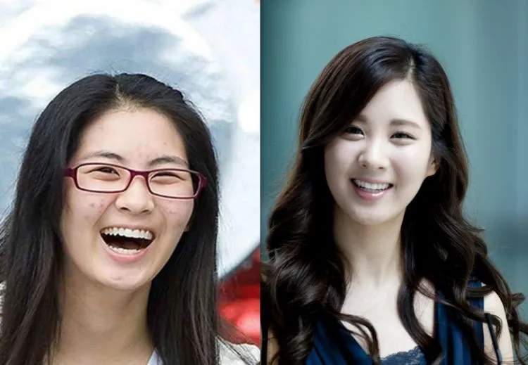 Nggak Ada yang Sempurna, Termasuk Kulit 8 Artis Korea Ini yang Tertangkap Kamera Sedang Berjerawat 14