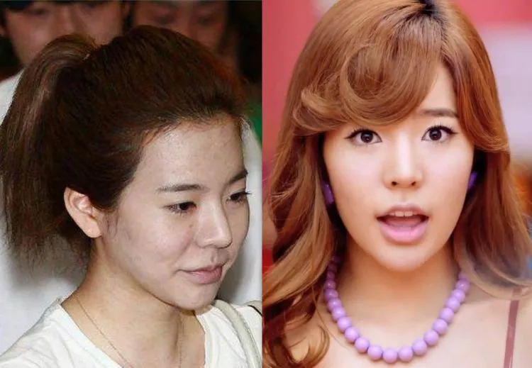 Nggak Ada yang Sempurna, Termasuk Kulit 8 Artis Korea Ini yang Tertangkap Kamera Sedang Berjerawat 9