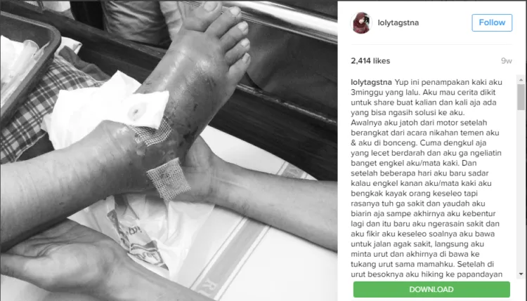 Belajar Memaknai Hidup dari Loly; Gadis Cantik yang Membuat Kita Lebih Waspada Terhadap Kanker 12