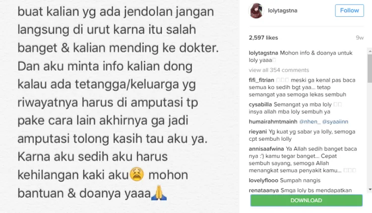 Belajar Memaknai Hidup dari Loly; Gadis Cantik yang Membuat Kita Lebih Waspada Terhadap Kanker 13