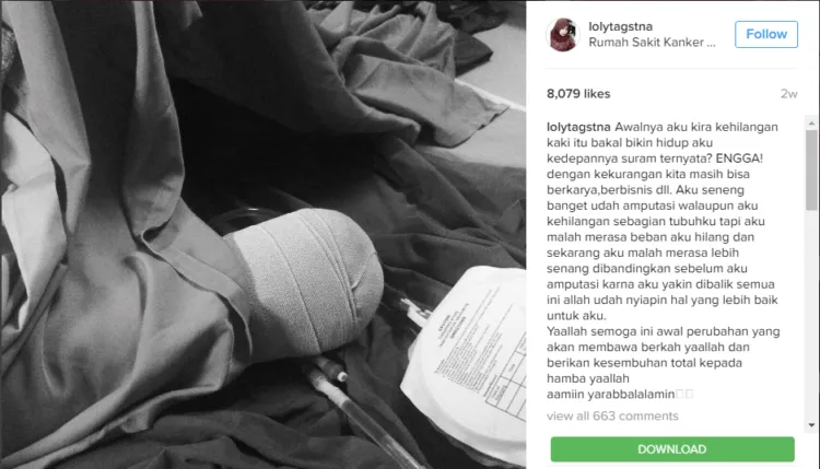 Belajar Memaknai Hidup dari Loly; Gadis Cantik yang Membuat Kita Lebih Waspada Terhadap Kanker 15
