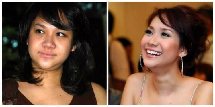 Artis Juga Manusia, 13 Foto Kekurangan Wajah Ini Adalah Bukti Kalau Kulit Mereka Bukan Sutra 16