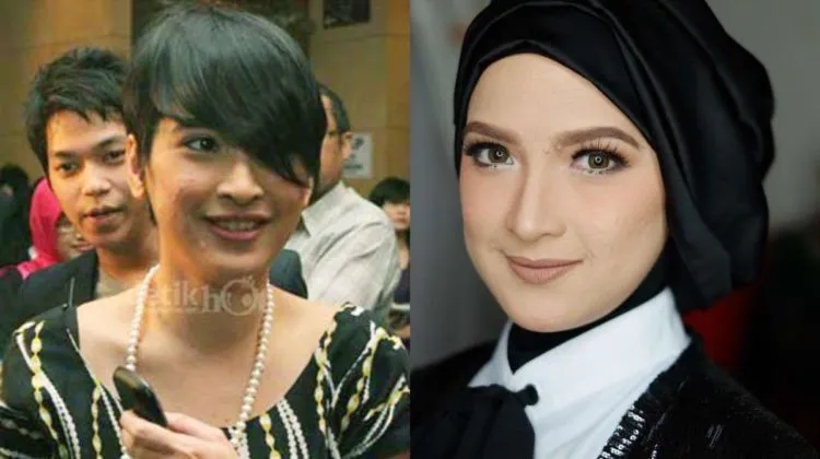 Artis Juga Manusia, 13 Foto Kekurangan Wajah Ini Adalah Bukti Kalau Kulit Mereka Bukan Sutra 15