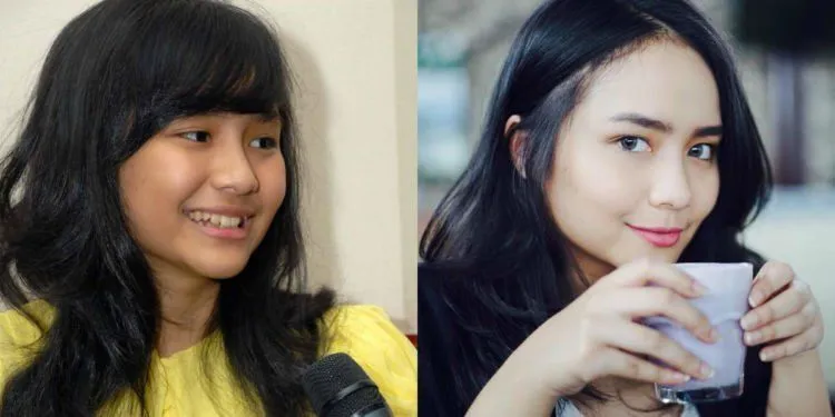 Artis Juga Manusia, 13 Foto Kekurangan Wajah Ini Adalah Bukti Kalau Kulit Mereka Bukan Sutra 19