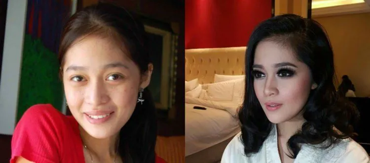 Artis Juga Manusia, 13 Foto Kekurangan Wajah Ini Adalah Bukti Kalau Kulit Mereka Bukan Sutra 20