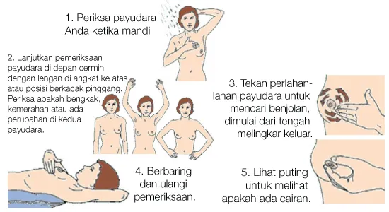 Kanker Payudara Bukan Ancaman Sepele! Dengan Baca Fakta dan Tips Ini, Satu Nyawa Bisa Selamat! 13