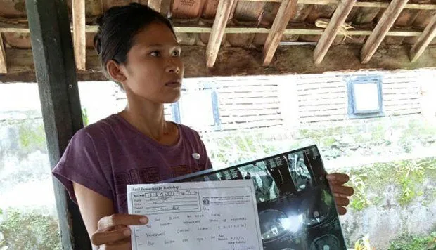 Mirisnya Nasib Pejuang Devisa Indonesia. Setelah 3 Tahun, TKW Ini Baru Sadar Ginjalnya Telah Dicuri 8