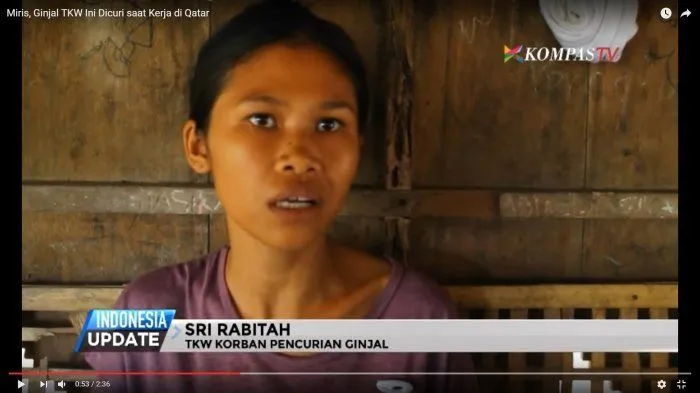 Mirisnya Nasib Pejuang Devisa Indonesia. Setelah 3 Tahun, TKW Ini Baru Sadar Ginjalnya Telah Dicuri 7