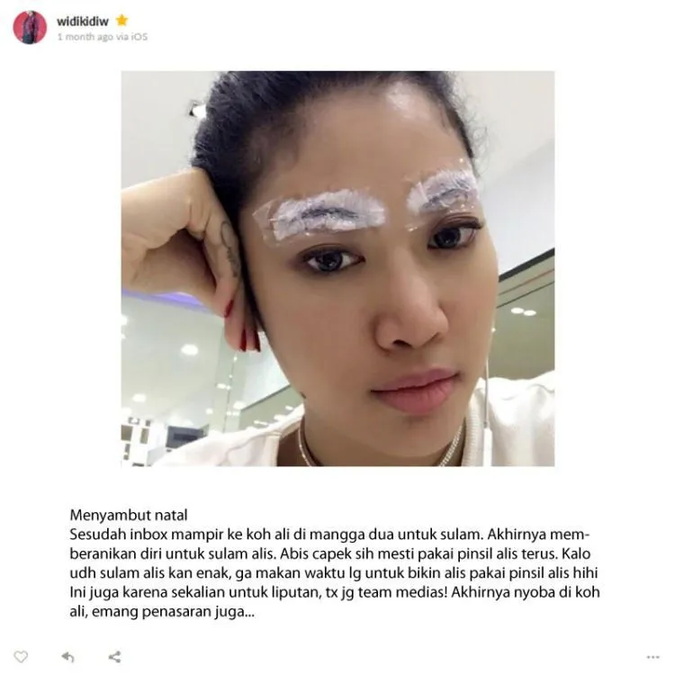 Dari Filler Hidung Sampai Infus Glowing. Yuk, Simak Cerita Pengalaman Widi Vierratale! 10