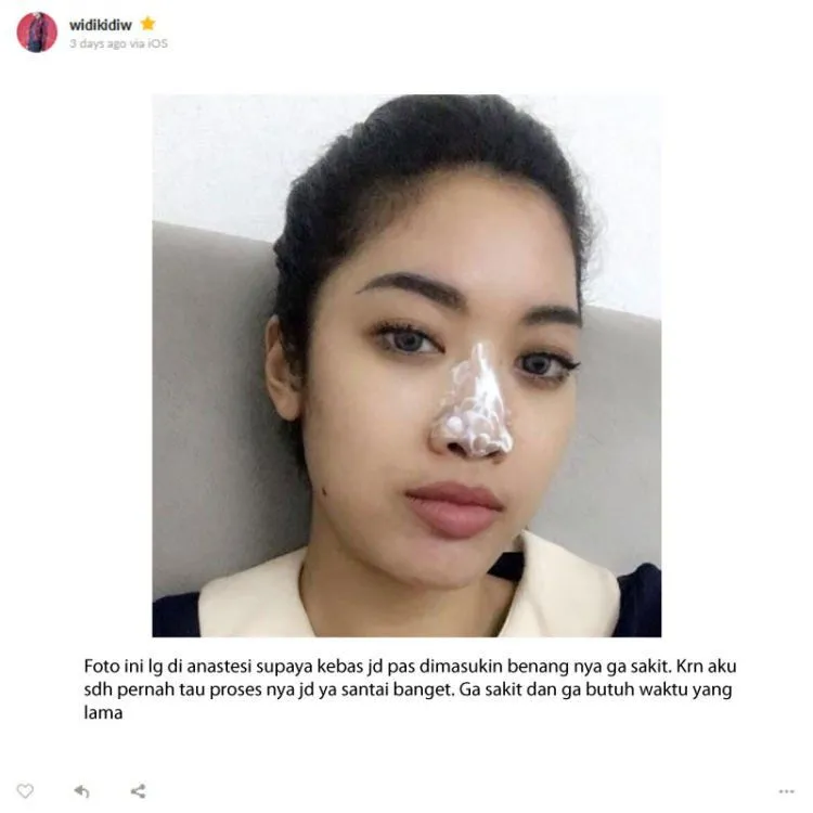 Dari Filler Hidung Sampai Infus Glowing. Yuk, Simak Cerita Pengalaman Widi Vierratale! 8