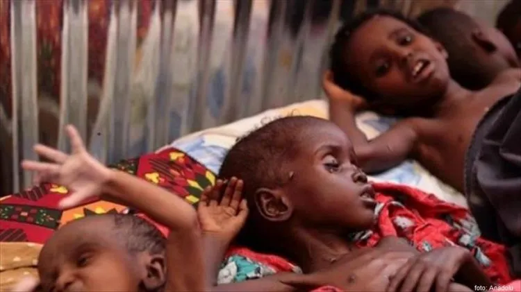 Ada yang Pusing Masalah Makanan Sisa, Di Belahan Dunia Lain Ternyata Ada Bencana Kelaparan Parah 20