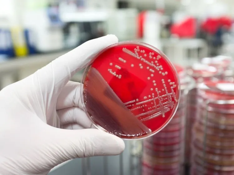 Dunia Kesehatan Siaga Satu. Ada 12 Bakteri yang Tak Mempan Lagi Dibasmi Dengan Antibiotik 8