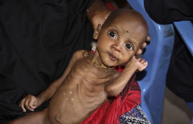 Ada yang Pusing Masalah Makanan Sisa, Di Belahan Dunia Lain Ternyata Ada Bencana Kelaparan Parah 17