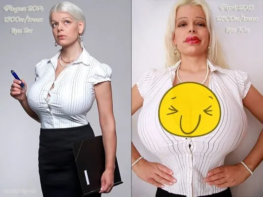 Wanita Ini Bisa Mengubah Ukuran Payudaranya Sesuka Hati Tanpa Operasi! Sungguh Anugerah yang Hakiki 6