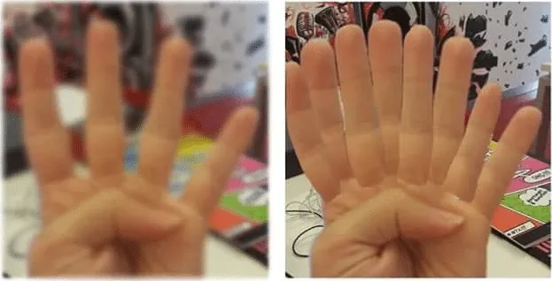 Bermata Sehat Tapi Pakai Kacamata Cuma buat Gaya, Pasti Mereka Belum Pernah Merasakan Kesedihan Ini!