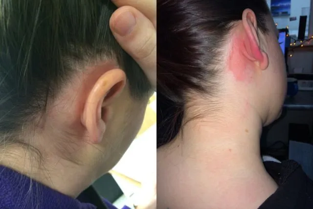 7 Cara Bedakan Henna Abal-abal dengan yang Asli Natural. Hati-hati, Kamu Bisa Aja Punya Alergi 13