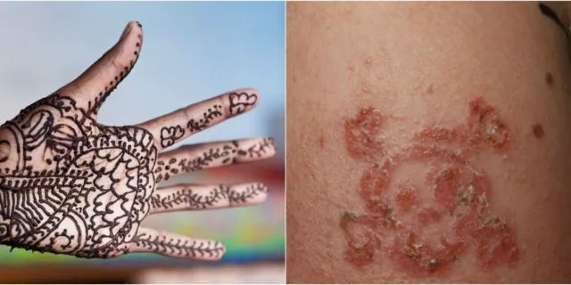 7 Cara Bedakan Henna Abal-abal dengan yang Asli Natural. Hati-hati, Kamu Bisa Aja Punya Alergi 9