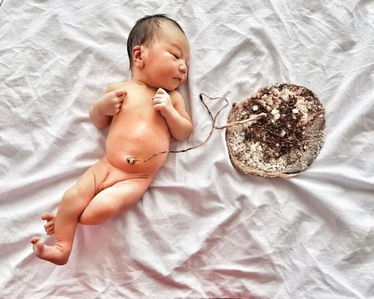 Jika Biasanya Setelah Bayi Lahir Langsung Dipotong Plasentanya, Lotus Birth Tidak. Ini Penjelasannya 8