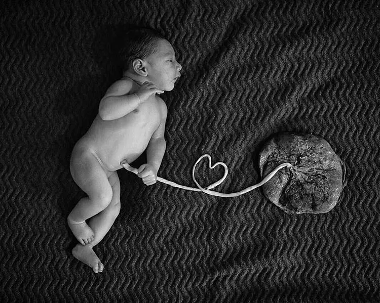 Jika Biasanya Setelah Bayi Lahir Langsung Dipotong Plasentanya, Lotus Birth Tidak. Ini Penjelasannya 10